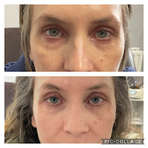 Rejuvenate Skinclinic