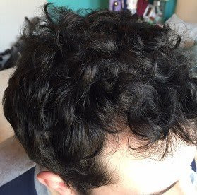 Hair And Scalp Clinic