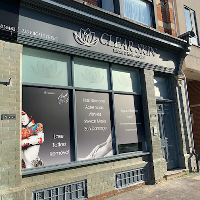 Clear Skin Laser Treatments