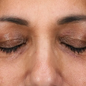 Toby Nelson Dermatology