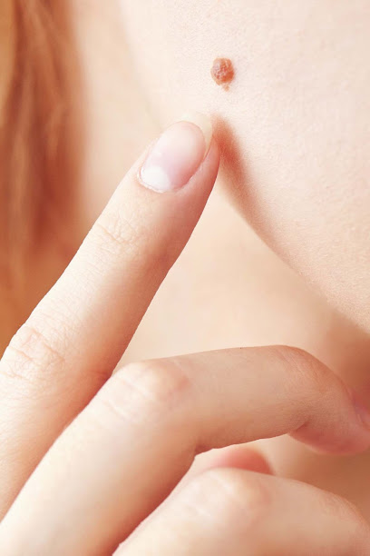 Stirling Skin Cancer Clinic