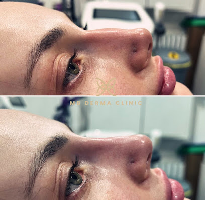 Mb Derma Clinic