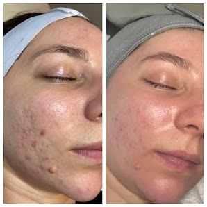 The Skin Investment Clinic Marlborough Wiltshire