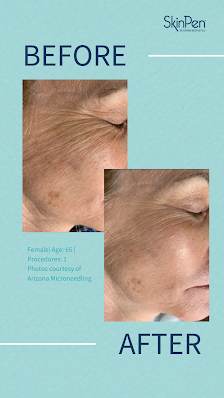 Rejuvenate Skin Clinic 1