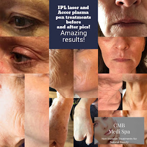 Cmb Medispa Plymouth
